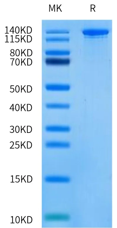 SDS-PAGE - SpCas9 D10A Nickase (Active) (AB316172)