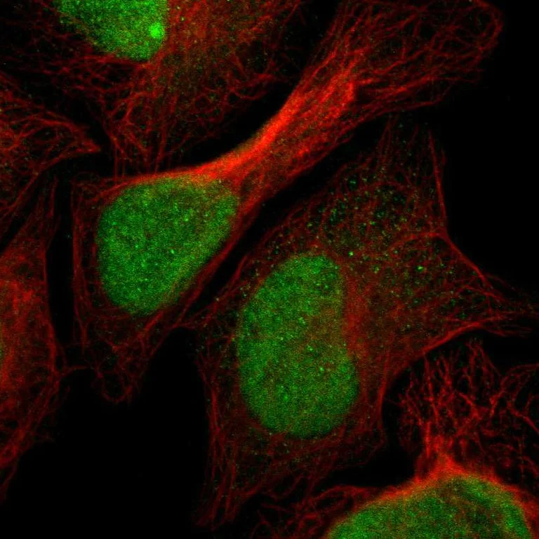 Immunocytochemistry/ Immunofluorescence - Anti-SPCS2/SPC25 antibody (AB121395)