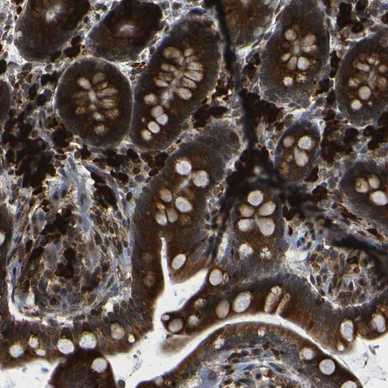 Immunohistochemistry (Formalin/PFA-fixed paraffin-embedded sections) - Anti-SPCS2/SPC25 antibody (AB121395)