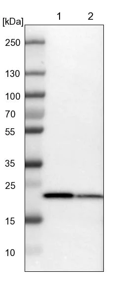 Western blot - Anti-SPCS2/SPC25 antibody (AB121395)