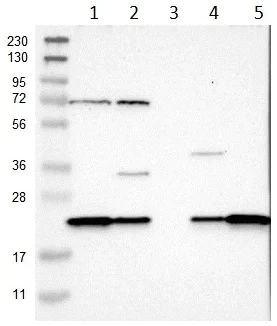 Western blot - Anti-SPCS2/SPC25 antibody (AB121395)