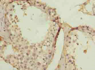 Immunohistochemistry (Formalin/PFA-fixed paraffin-embedded sections) - Anti-SPCS2/SPC25 antibody (AB236972)