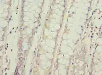Immunohistochemistry (Formalin/PFA-fixed paraffin-embedded sections) - Anti-SPCS2/SPC25 antibody (AB236972)