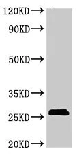 Western blot - Anti-SPCS2/SPC25 antibody (AB236972)