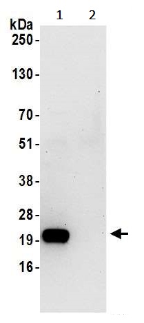 Immunoprecipitation - Anti-SPCS2/SPC25 antibody (AB242101)