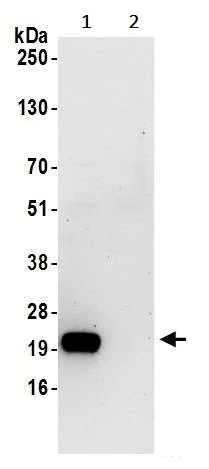 Immunoprecipitation - Anti-SPCS2/SPC25 antibody (AB242101)