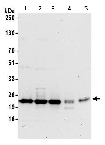 Western blot - Anti-SPCS2/SPC25 antibody (AB242101)