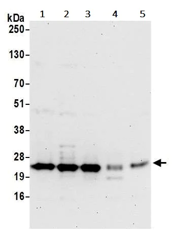 Western blot - Anti-SPCS2/SPC25 antibody (AB242101)