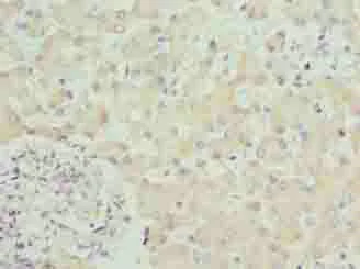 Immunohistochemistry (Formalin/PFA-fixed paraffin-embedded sections) - Anti-SPCS3 antibody (AB235598)