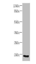 Western blot - Anti-SPCS3 antibody (AB235598)