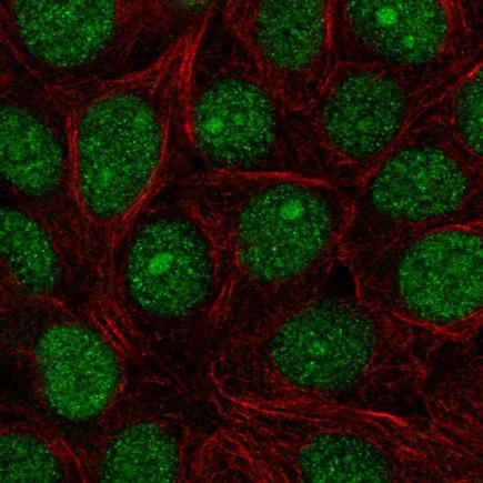 Immunocytochemistry/ Immunofluorescence - Anti-SPDEF/PSE antibody (AB220776), expandable thumbnail