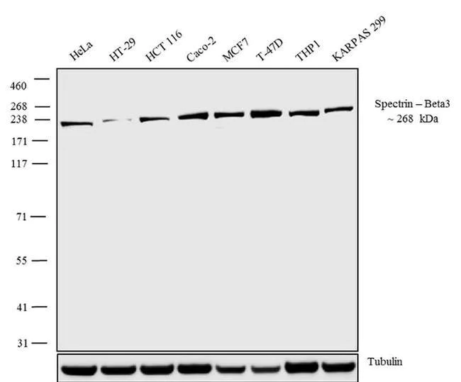 Western blot - Anti-Spectrin beta-3 antibody [RP23040210] (AB308134)