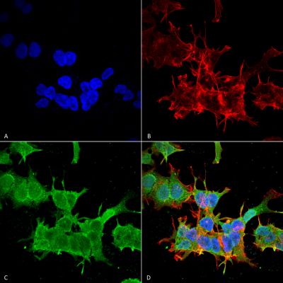 Immunocytochemistry/ Immunofluorescence - Anti-Spectrin beta chain, brain 3 antibody [S393-2] (AB241997), expandable thumbnail