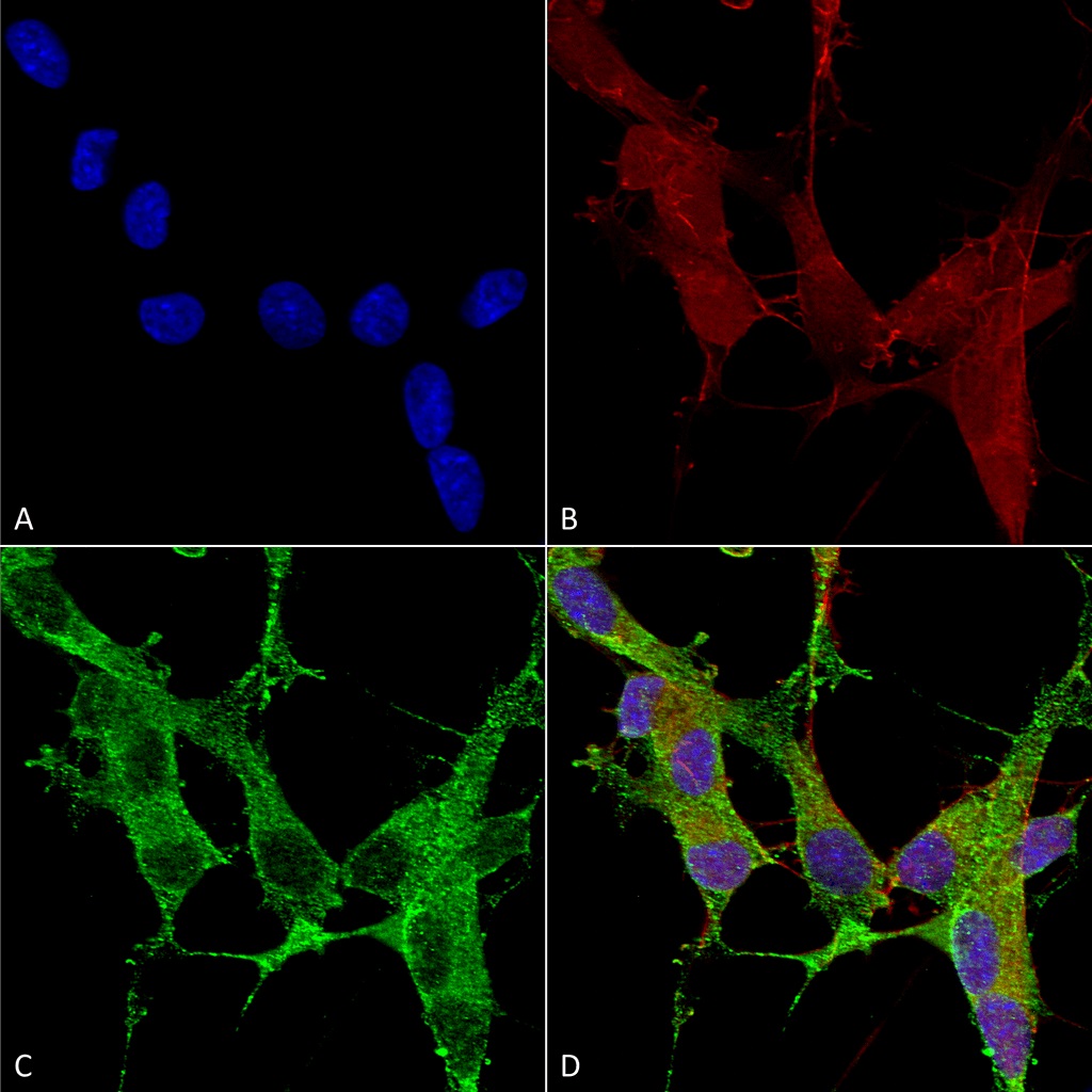 Immunocytochemistry/ Immunofluorescence - Anti-Spectrin beta chain, brain 3 antibody [S393-2] (AB241997), expandable thumbnail