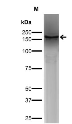 Western blot - Anti-Spectrin beta chain, brain 3 antibody [S393-2] (AB241997), expandable thumbnail