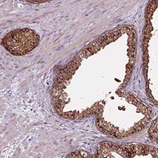 Immunohistochemistry (Formalin/PFA-fixed paraffin-embedded sections) - Anti-SPEF1 antibody (AB151100), expandable thumbnail