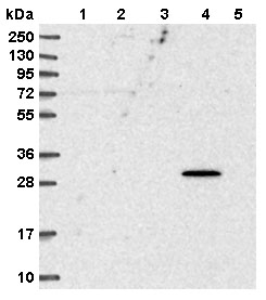 Western blot - Anti-SPEF1 antibody (AB151100), expandable thumbnail