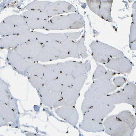 Immunohistochemistry (Formalin/PFA-fixed paraffin-embedded sections) - Anti-SPEN antibody (AB244347)