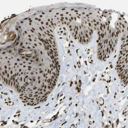 Immunohistochemistry (Formalin/PFA-fixed paraffin-embedded sections) - Anti-SPEN antibody (AB244347)