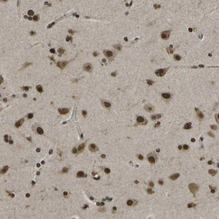 Immunohistochemistry (Formalin/PFA-fixed paraffin-embedded sections) - Anti-SPEN antibody (AB244347)