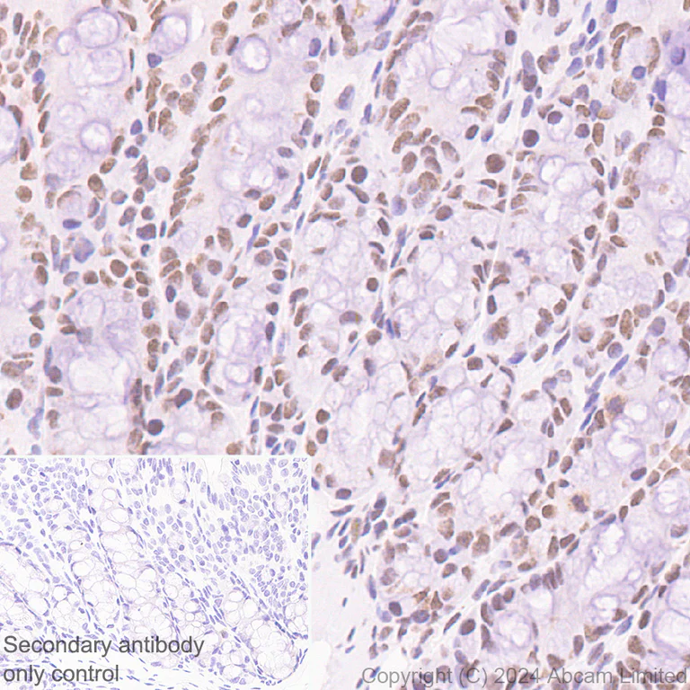 Immunohistochemistry (Formalin/PFA-fixed paraffin-embedded sections) - Anti-SPEN antibody [EPR28618-77] (AB319043)