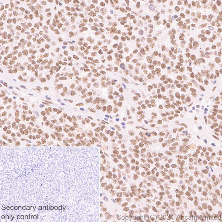Immunohistochemistry (Formalin/PFA-fixed paraffin-embedded sections) - Anti-SPEN antibody [EPR28618-77] - BSA and Azide free (AB319044)