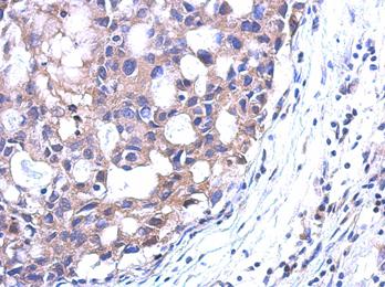 Immunohistochemistry (Formalin/PFA-fixed paraffin-embedded sections) - Anti-Spermidine synthase antibody (AB111884), expandable thumbnail