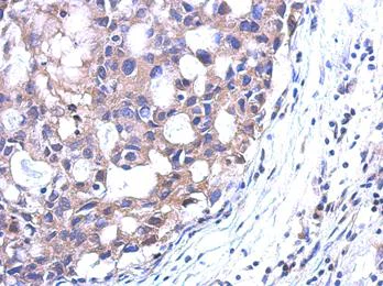 Immunohistochemistry (Formalin/PFA-fixed paraffin-embedded sections) - Anti-Spermidine synthase antibody (AB111884)