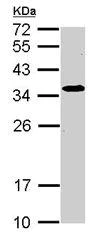 Western blot - Anti-Spermidine synthase antibody (AB111884)