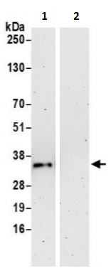 Immunoprecipitation - Anti-Spermidine synthase antibody (AB241496)