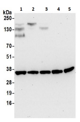 Western blot - Anti-Spermidine synthase antibody (AB241496)