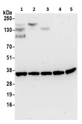 Western blot - Anti-Spermidine synthase antibody (AB241496)