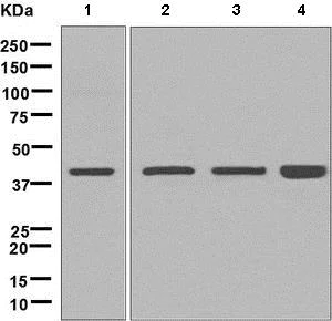 Western blot - Anti-Spermine synthase antibody [EPR9252(B)] (AB156879)