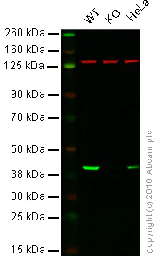 Western blot - Anti-Spermine synthase antibody [EPR9252(B)] (AB156879)