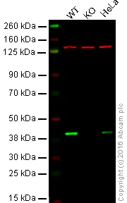 Western blot - Anti-Spermine synthase antibody [EPR9253] (AB151547)