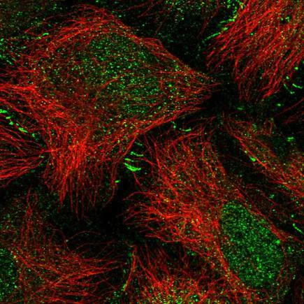 Immunocytochemistry/ Immunofluorescence - Anti-SPERT antibody (AB243570)