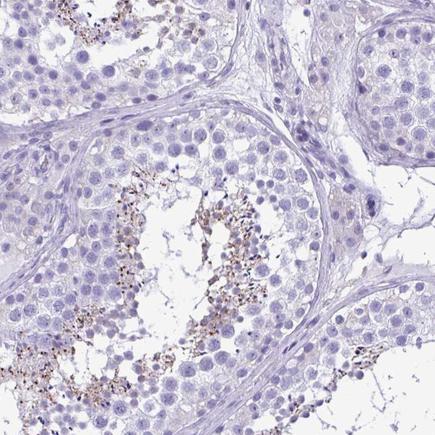 Immunohistochemistry (Formalin/PFA-fixed paraffin-embedded sections) - Anti-SPERT antibody (AB243570)