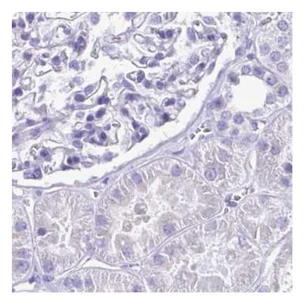 Immunohistochemistry (Formalin/PFA-fixed paraffin-embedded sections) - Anti-SPERT antibody (AB243570)
