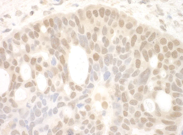 Immunohistochemistry (Formalin/PFA-fixed paraffin-embedded sections) - Anti-SPF45 antibody (AB114968)