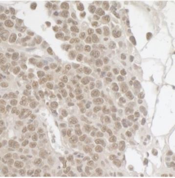 Immunohistochemistry (Formalin/PFA-fixed paraffin-embedded sections) - Anti-SPF45 antibody (AB114968)