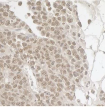 Immunohistochemistry (Formalin/PFA-fixed paraffin-embedded sections) - Anti-SPF45 antibody (AB114968)