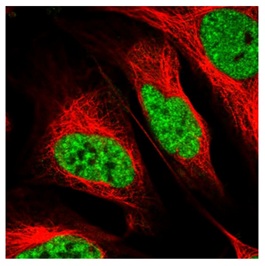 Immunocytochemistry/ Immunofluorescence - Anti-SPF45 antibody (AB204333), expandable thumbnail