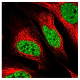 Immunocytochemistry/ Immunofluorescence - Anti-SPF45 antibody (AB204333)