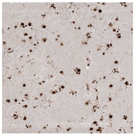 Immunohistochemistry (Formalin/PFA-fixed paraffin-embedded sections) - Anti-SPF45 antibody (AB204333), expandable thumbnail