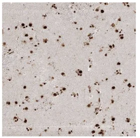 Immunohistochemistry (Formalin/PFA-fixed paraffin-embedded sections) - Anti-SPF45 antibody (AB204333)