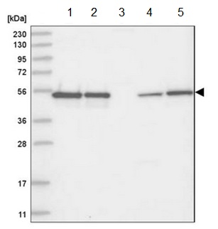 Western blot - Anti-SPF45 antibody (AB204333), expandable thumbnail