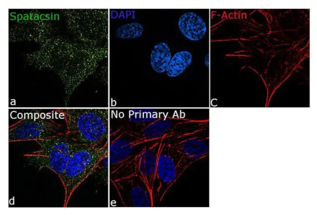Immunocytochemistry/ Immunofluorescence - Anti-SPG11 Antibody [RP23040242] (AB313498)