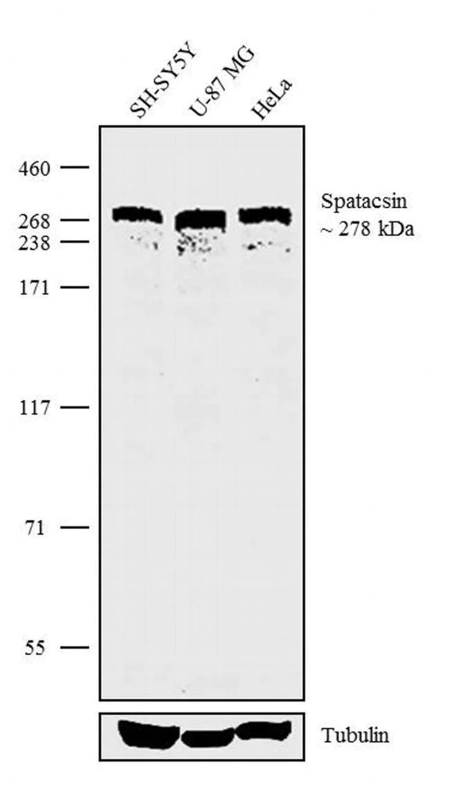 Western blot - Anti-SPG11 Antibody [RP23040242] (AB313498)