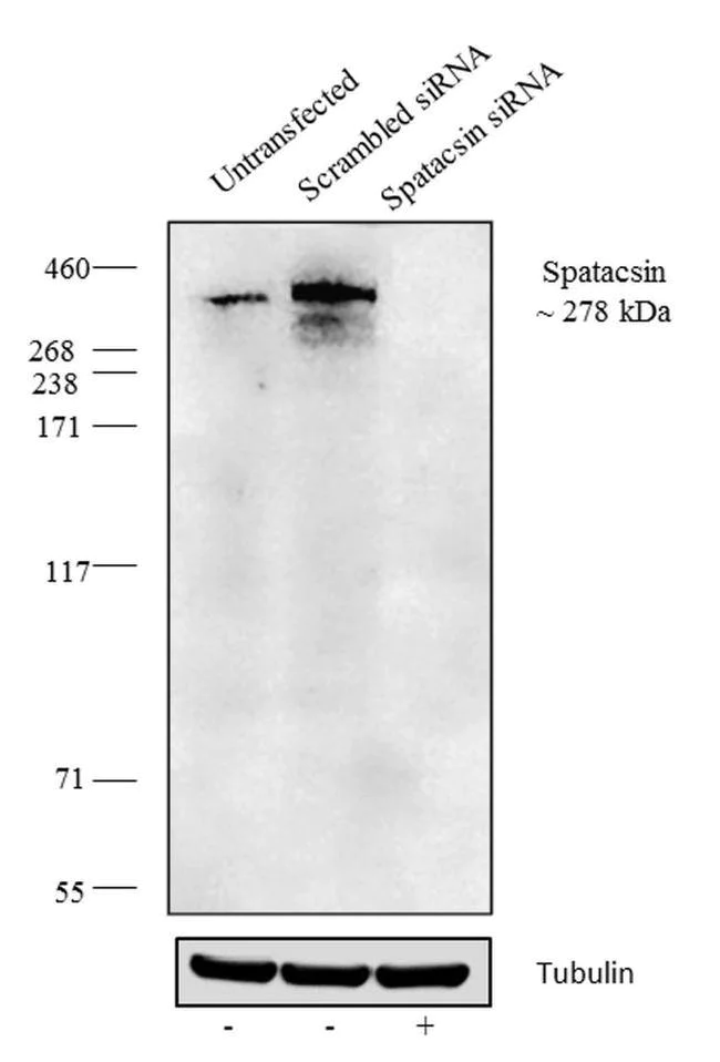 Western blot - Anti-SPG11 Antibody [RP23040242] (AB313498)