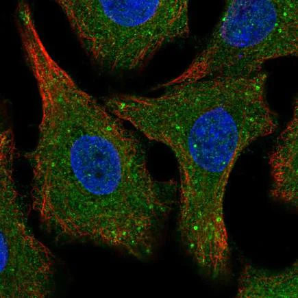 Immunocytochemistry/ Immunofluorescence - Anti-SPG21/Maspardin antibody (AB220229)